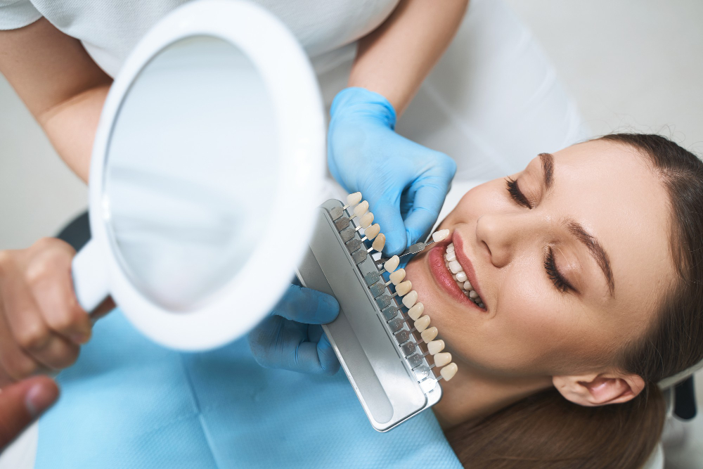 Veneers